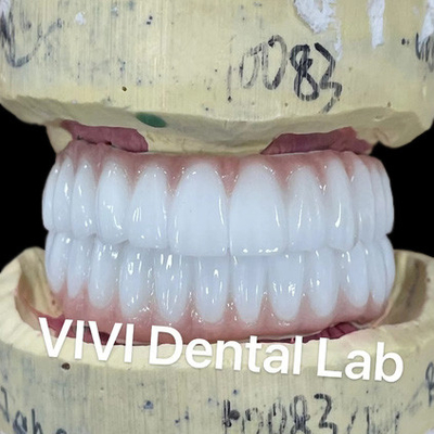 Ni Be Free Zirconia Dental Implant Bridge On Bar উচ্চ সৌন্দর্য