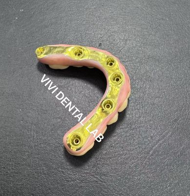 টাইটানিয়াম বার সমর্থন সঙ্গে সম্পূর্ণ Zirconia ব্রিজ চীন ডেন্টাল ল্যাব