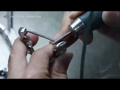 পিএফএম মুকুট এবং সেতু