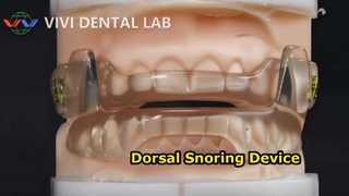 অ্যান্টি স্নোরিং ডেন্টাল ডিভাইস
